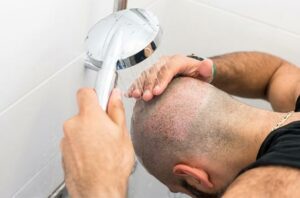 نکات مهم حمام کردن پس از کاشت مو
