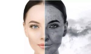 چگونه از پوست خود در برابر آلودگی‌های محیطی محافظت کنیم؟