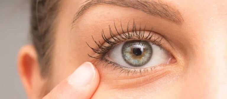 👁️ آیا استفاده از کرم دور چشم در سنین جوانی ضروری است؟